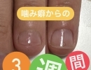 【Loveit nails】噛み癖克服〜･:*+.