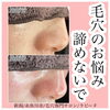 毛穴のお悩み諦めないで「もう毛穴に悩まない‼︎」