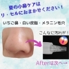 毛穴や小鼻の悩みは肌のプロに任せてください！「【小鼻】の悩みはリ・セルで徹底ケア！【宮崎市・フェイシャルエステ・RECELL・毛穴洗浄・いちご鼻・黒ずみ・シミ取り・水素・リフトアップ・美白ケア】」