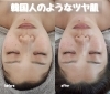 「韓国人のような艶々肌♡【 福井 / 福井市 / ハーブ / ハーブピーリング / ツヤ肌 / 陶肌 / むくみ解消 / トーンアップ  】」