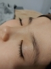 子ども脱毛「子ども脱毛　viage 川西　鼓が滝　脱毛サロン」