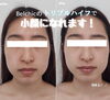 コラーゲンも生成されます♪「しっかりと引き上げて美しいフェイスラインへ【福井市ハイフ/福井市エステ/ハイフ/小顔】」
