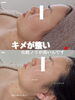 「大事な日のためにお肌を綺麗に♩【 福井 / 福井市 / ハーブピーリング / ＲＥＶＩ / 優しいピーリング /  むくみ解消 / つや肌 /  敏感肌 / ニキビ肌 / アトピー肌 】」