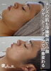 「メンズもピーリングで褒められ肌に【 福井 / 福井市 / エステ / ハーブピーリング /メンズ歓迎 / 美肌 / むくみ / 毛穴 / にきび / にきび跡 / リフトアップ / トーンアップ 】」