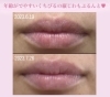 [30代女性]リブセラはくちびるにもあてられます☆「夏にフェイシャルケアして綺麗な肌で秋を迎えましょう♡【夏の強い日差しのダメージは一気に老化スピードを加速させます💦秋までにツヤ肌・フェイスラインスッキリ・毛穴のザラつき綺麗にしたいなら松山市枝松のTiAMでケアしましょう】」