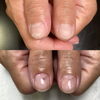 「深爪緩和【札幌市南区川沿 ネイルサロン nailsalon Rubino】」