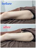 キラ肌痩身⭐︎ダイエットメニュー「【キラ肌痩身】before  after✨️✨️」