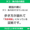 「タコ・魚の目の原因は歩き方⁉︎ 【 外反母趾や巻き爪、足の悩み専門整体/千葉県船橋市西船徒歩2分】」