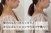 首まで長く見えるように♪「まだ間に合う❣️お盆までに横顔美人へ【福井エステ/福井ハイフ/横顔美人/福井小顔】」