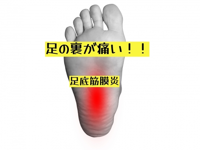 足底筋膜炎「足の裏orかかとの痛みは足底筋膜炎かも？」