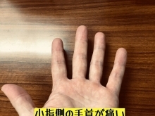 小指側の手首の痛みはTFCC損傷