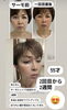 サーモシェイプ&美容鍼「山陰初の美容鍼に、肩甲骨はがし、ボディケア」