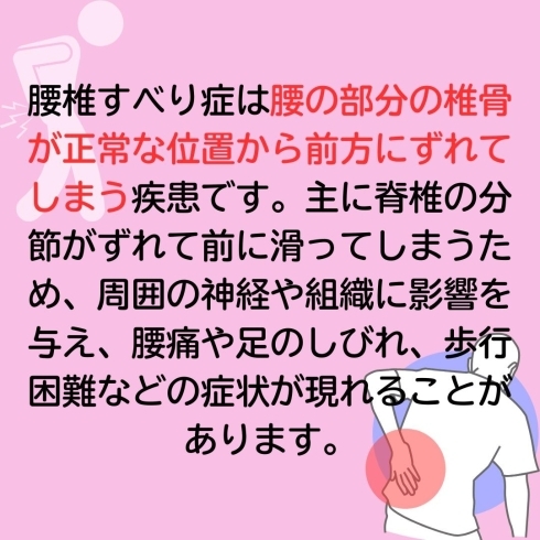 腰椎すべり症とは？「腰椎すべり症とは？」