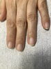 「二枚爪にお悩みの方【札幌市南区川沿 ネイルサロン nailsalon Rubino】」