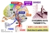 身体図式「片麻痺の人の手」