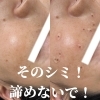 「南魚沼のSifaなら、そのシミ諦めないで大丈夫！」