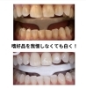 メディカルホワイトニング「メディカルホワイトニング」