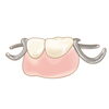 「インプラント治療のメリットとデメリット」
