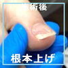 No.83　根本上げ施術事例写真４「No.83 では根本からあげていきましょうね！」