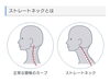 首のアーチありますか？「首ケアしましょ(◍•ᴗ•◍)✧*。」