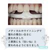 after「メディカルホワイトニング」