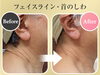 BeforeAfter「福井エステサロンMEIS Beauty Salon福井店 – 毎日のUVケアで美肌を守る方法」
