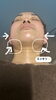 「半顔施術後」