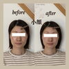 「「顔が長くなった？」年齢だけじゃない、お顔の印象の変化。」
