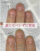 「看護師さんも爪育成【福井/ネイル/自爪育成】」