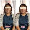 全体的に上がり、頬の骨の位置が高くなりましたね「【NEW】3D小顔矯正／頭蓋骨矯正／船橋市／温熱整体namikoの新メニュー」