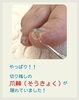 巻き爪の方に起きやすいトラブル！「巻き爪で起こる二次トラブル⁈」