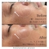 brow waxing ワックス脱毛 10個 | bbqislands.net