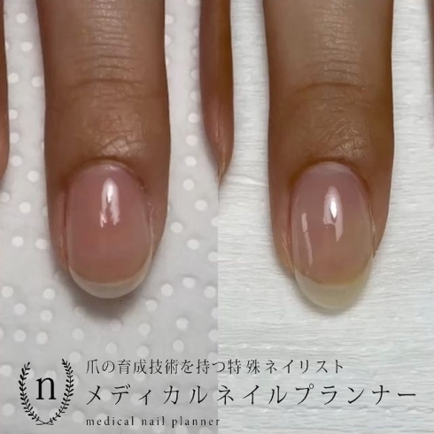 自爪育成 自爪風ネイル オフィスネイルも 美爪を追求 ケア重視 福井のネイルサロン Nail Salon Alohaloma アロハロマ のニュース まいぷれ 福井 自爪育成 自爪風ネイル オフィスネイルも 美爪を追求 ケア重視 福井のネイルサロン Nail Salon Alohaloma アロハロマ のニュース まいぷれ 福井