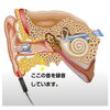 鼓膜と補聴器の間の空間で測定して録音「【検証】次世代LE Audio搭載補聴器と従来型がどう違うか、実耳測定で比較してみた　Bluetooth比較視聴　鼓膜面上の音源を聞くことができます　認定技能者2名在籍　補聴器専門店　リサウンド/フォナック/オーティコン」