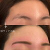 ナチュラル美眉へと悩みを解決「眉ワックスで印象チェンジ♪ビフォーアフターのご紹介」
