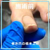 根本から立ち上げて美しい爪に　No.102-3「根本から立ち上げて美しい爪に　No.102」