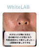 「30年気になっていたシミのお悩みにも◎WhiteLABで消えました」
