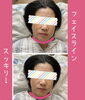 頭蓋骨触っただけです「梅雨ダルには脳セラピー🧠」