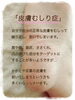 皮膚むしり症とフットケア「皮膚むしり症とフットケア」
