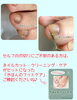 爪棘（そうきょく）「【足爪ケア】いつの間にか⁈痛〜いトゲ‼︎」