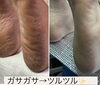 「フットネイル半額！フットケアデラックスをするとネイル半額キャンペーン☆」