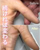 「手荒れ改善【福井市/ネイル/乾燥】」