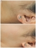 ↑Before/↓After「梅雨前のザラつき肌に♪よもぎ蒸し＋シェービングでやさしくリセット」