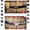 メディカルホワイトニング「お客様紹介」