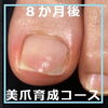 N79.美爪育成コースの施術事例４「N79.美爪育成コースの施術事例」