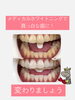 白くなりましょ「輝く白い歯」