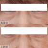 「さよなら目のクマさん👋【 福井 / 福井市 / 福井エステ / 小顔 / ハイフ / 目の下 / クマ / たるみ / リフトアップ  】」