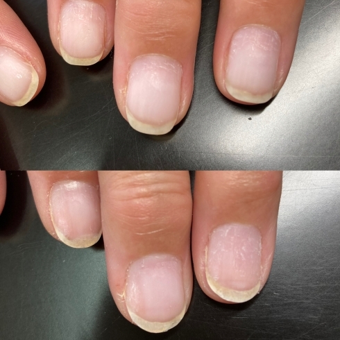 自爪育成 札幌市南区川沿 ネイルサロン Nail Salon Rubino Nailsalon Rubinoのニュース まいぷれ 札幌市南区 自爪育成 札幌市南区川沿 ネイルサロン Nail Salon Rubino Nailsalon Rubinoのニュース まいぷれ 札幌市南区