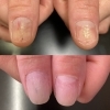 自爪育成ジェルコース　