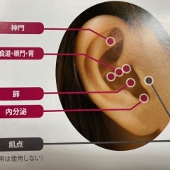 耳つぼ施術
